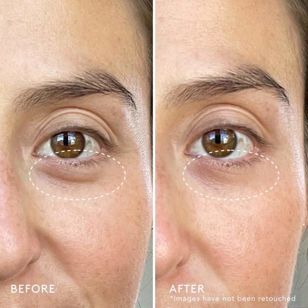 Super Nova Vitamin C Brightening Eye Cream - Image 4